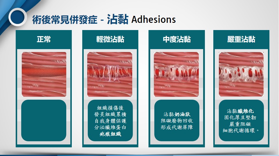 沾黏反應影像1